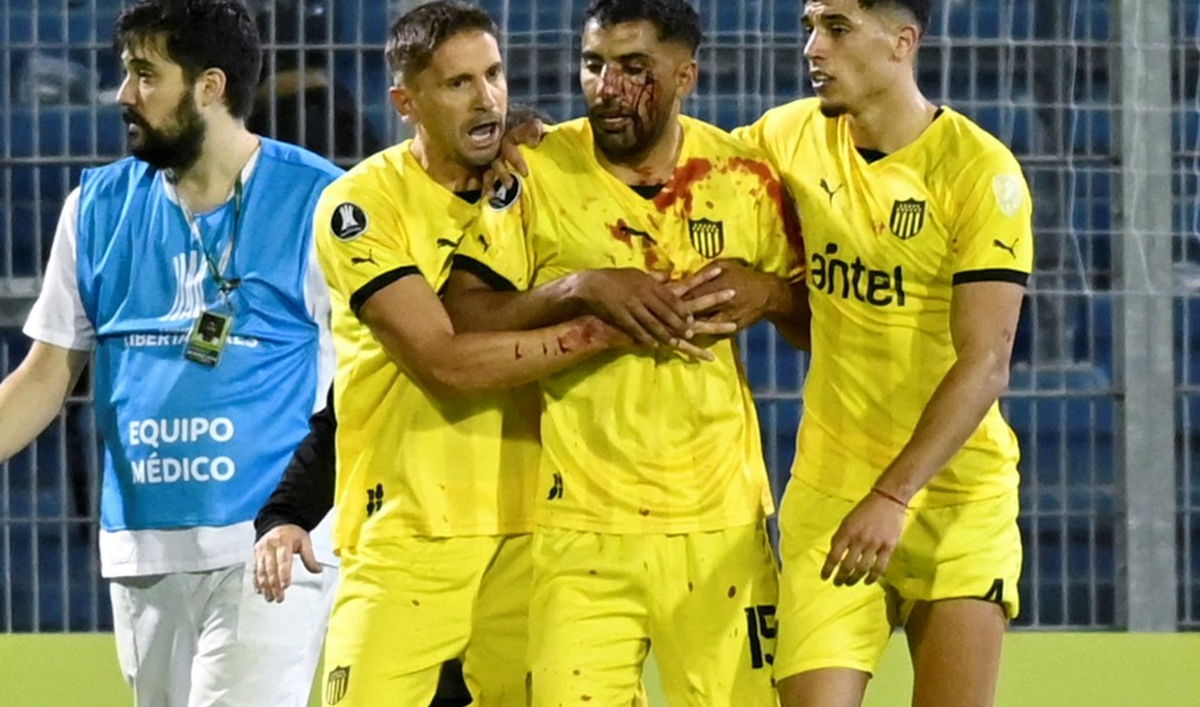 Rosario Central informó que suspendió al hincha que agredió al jugador de Peñarol.