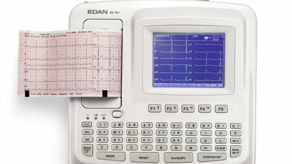 El electrocardiógrafo detecta las señales eléctricas asociadas con la actividad cardíaca y producen un electrocardiograma.