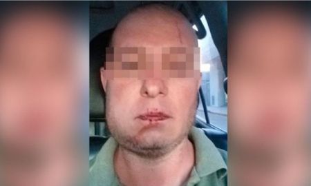Cuatro policías detuvieron a un hombre por error y le quebraron la mandíbula Cuatro policías detuvieron a un hombre por error y le quebraron la mandíbula