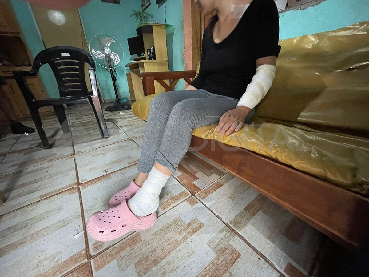 Keila, víctima del accidente, habló con AIRE tras el fuerte accidente que la dejó malherida. Keila, víctima del accidente, habló con AIRE tras el fuerte accidente que la dejó malherida.