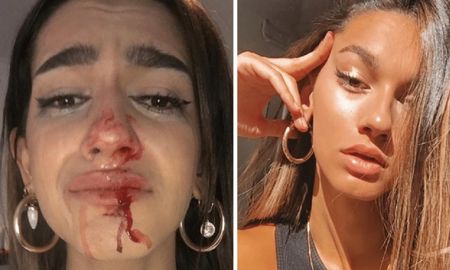 Una influencer trans sufrió una brutal golpiza en la calle Una influencer trans sufrió una brutal golpiza en la calle