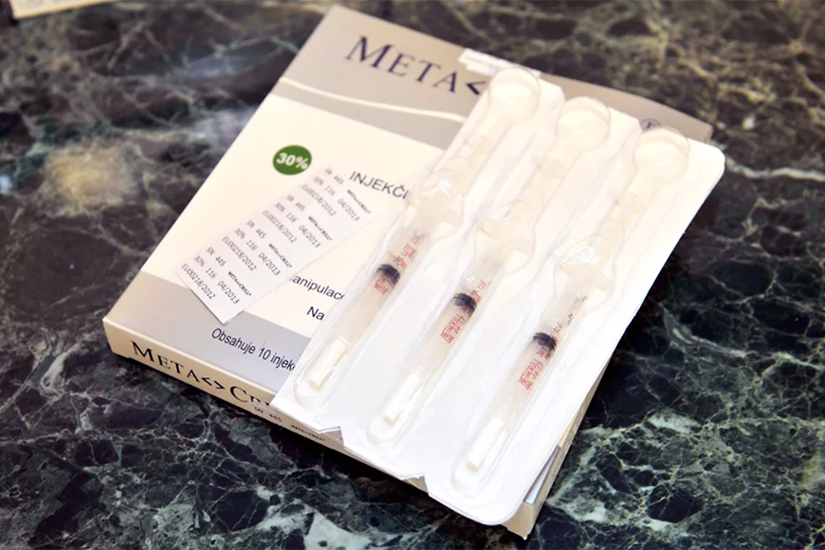 El metacrilato ya no es una sustancia aprobada por la ANMAT. El metacrilato ya no es una sustancia aprobada por la ANMAT.