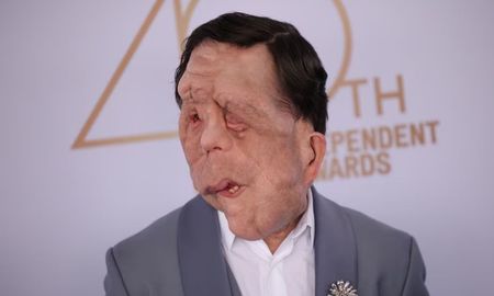 Adam Pearson deslumbró con un traje de Amiri y accesorios de lujo, demostrando que el talento no tiene etiquetas. Adam Pearson deslumbró con un traje de Amiri y accesorios de lujo, demostrando que el talento no tiene etiquetas.
