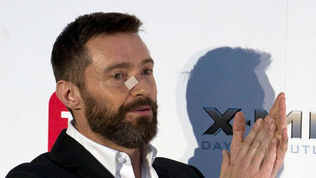 Hugh Jackman se había realizado biopsias por sospechas de cáncer de piel en 2016.
