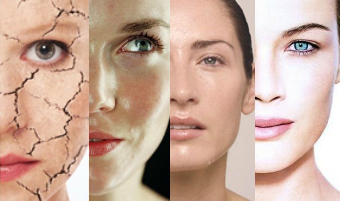 Descubrí los diferentes tipos de piel y sus características