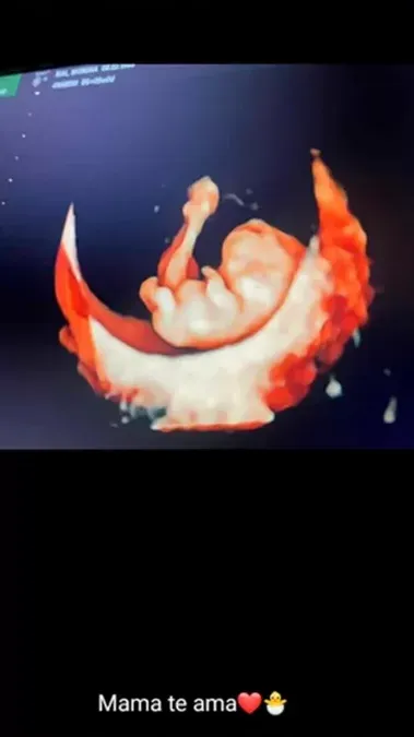 Morena Rial había mostrado la ecografía de su bebé hace algunas semanas.