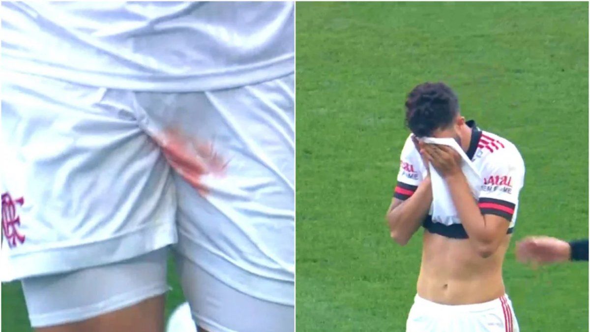 Le pisaron los testículos en el medio del partido