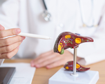 La detección temprana mediante ecografía permite identificar la esteatosis hepática metabólica antes de que se presenten complicaciones graves.