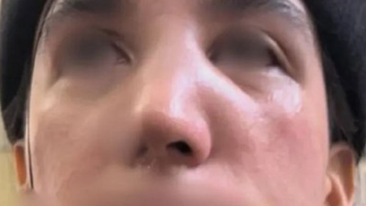 El hombre las golpeó por su vestimenta.