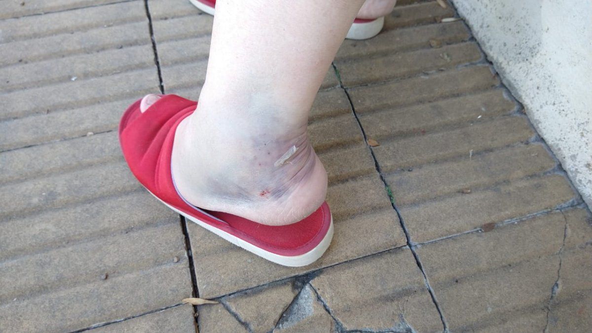 La rueda del coche golpeó el tobillo de la vecina. 