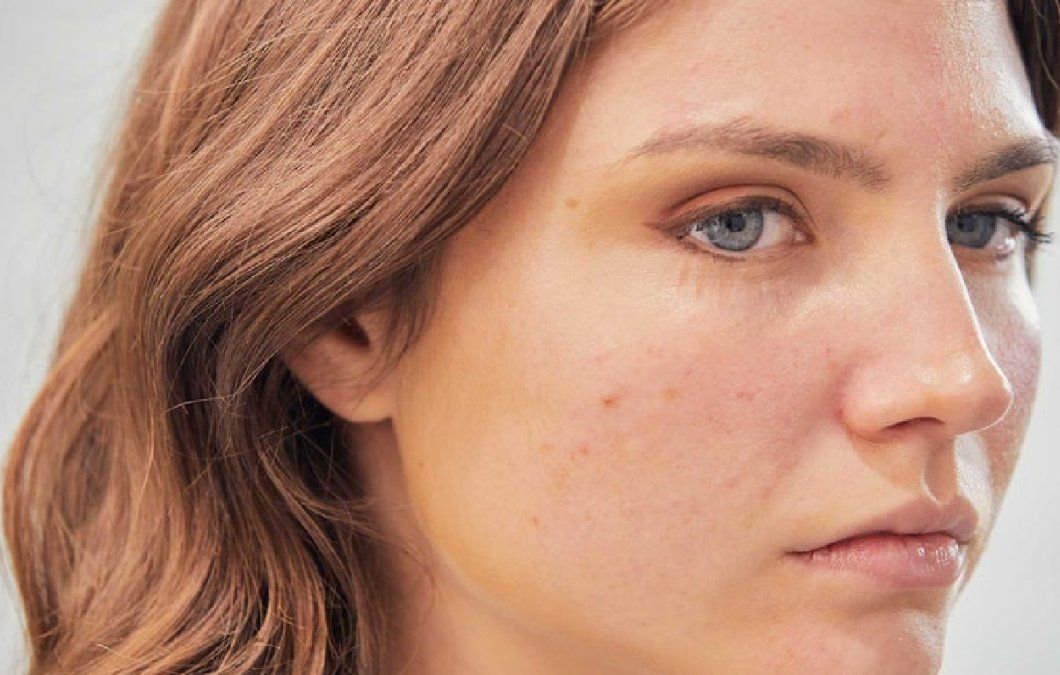 5 claves para corregir un tono de piel desparejo