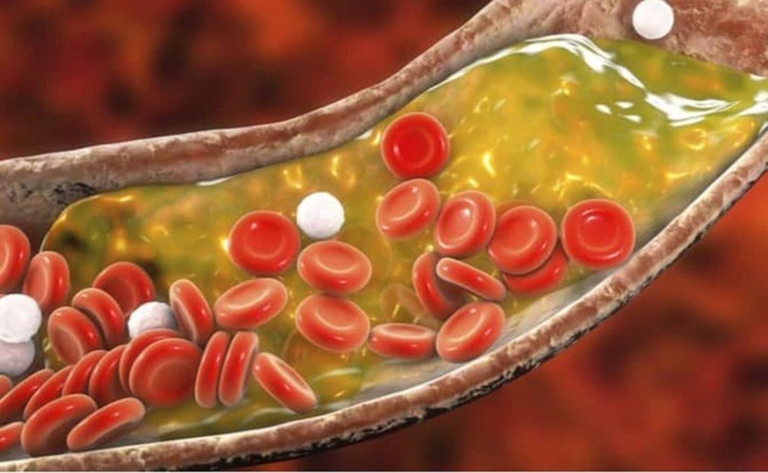 Las propiedades del limón están vinculadas directamente con la sangre dada su influencia a la hora de favorecer el sistema circulatorio.