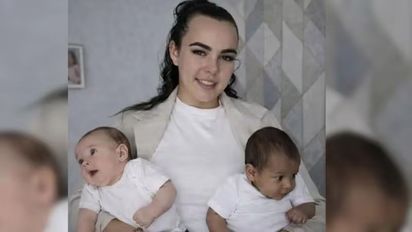 El insólito caso de los gemelos con distintos padres biológicos: la ciencia explica el fenómeno que sacude a Brasil