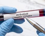 El reporte nacional de situaci+ón de coronavirus informó un nuevo caso en la provincia de Santa Fe. El reporte nacional de situaci+ón de coronavirus informó un nuevo caso en la provincia de Santa Fe.
