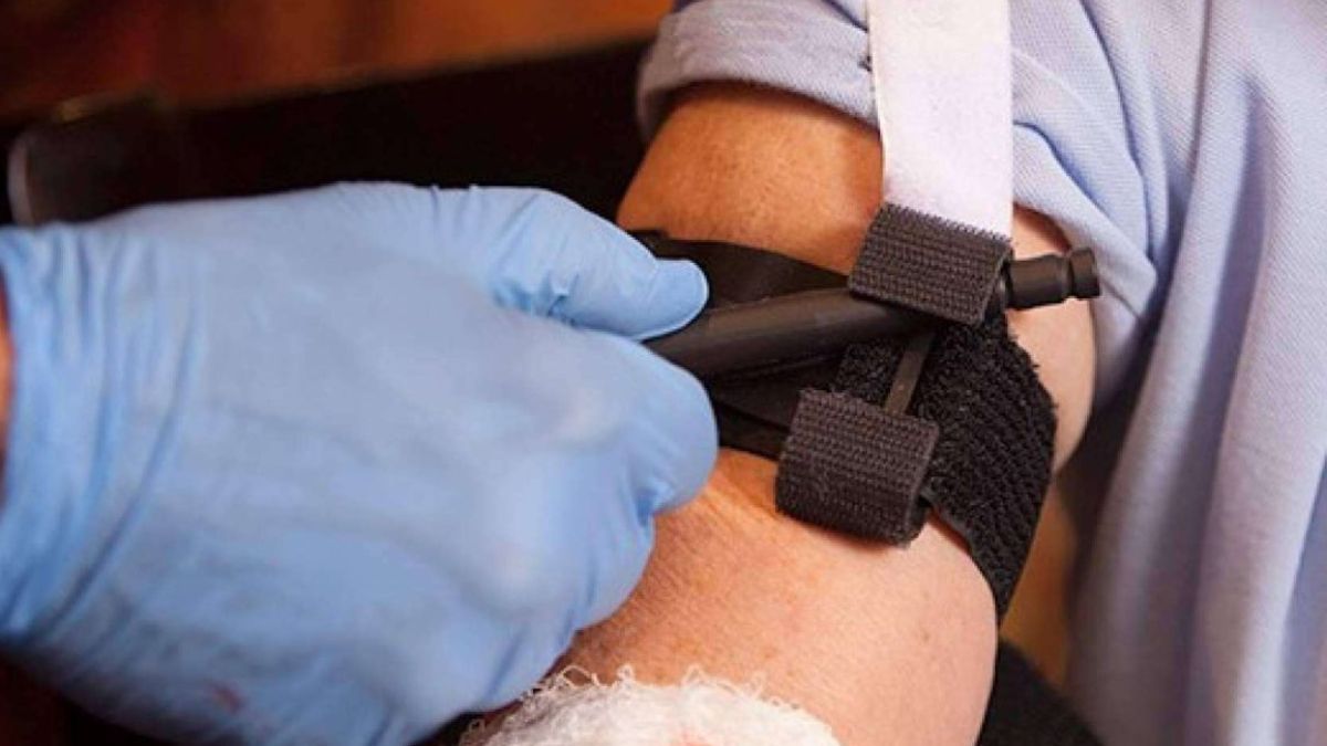 Cómo realizar un torniquete para detener una hemorragia.