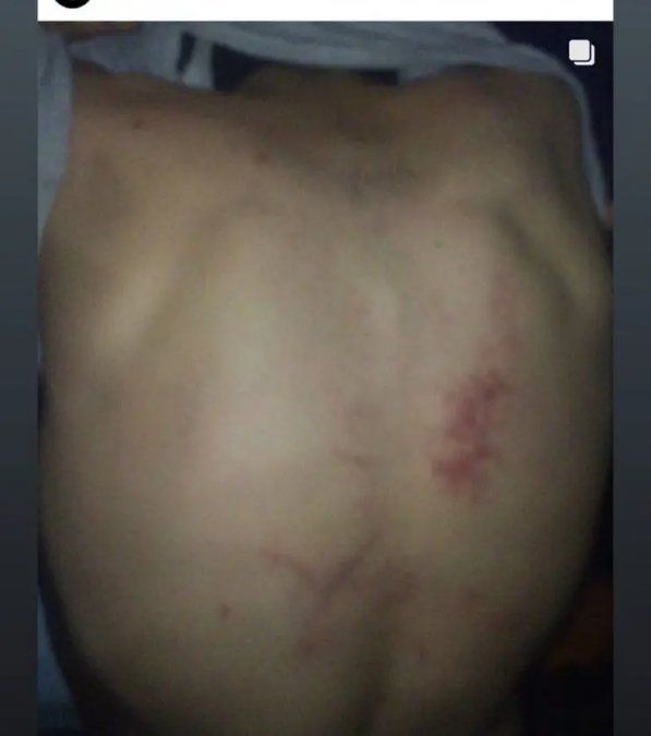 Por las redes sociales, los skaters mostraron los rastros de los golpes durante el enfrentamiento con los agentes.