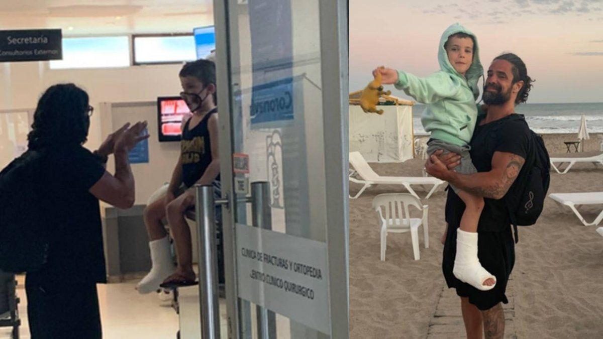 Fausto, el hijo de Luciano Castro y Sabrina Rojas, se fracturó la pierna.