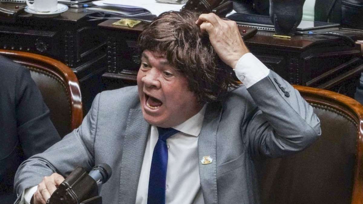 La imagen de Leiva con la peluca se volvió tendencia en las redes sociales. 