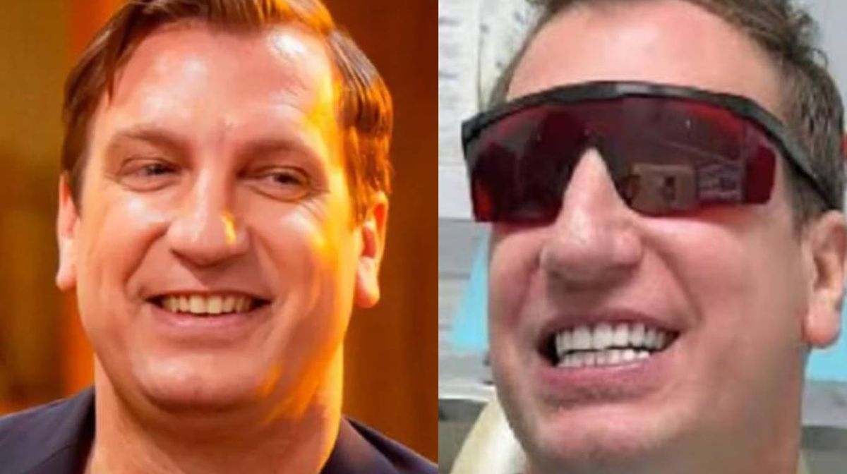 Maxi López se puso carillas, pero en las redes aseguran que le quedaron mal. Maxi López se puso carillas, pero en las redes aseguran que le quedaron mal.