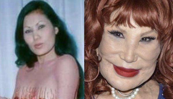 El antes y después de Lyn May.