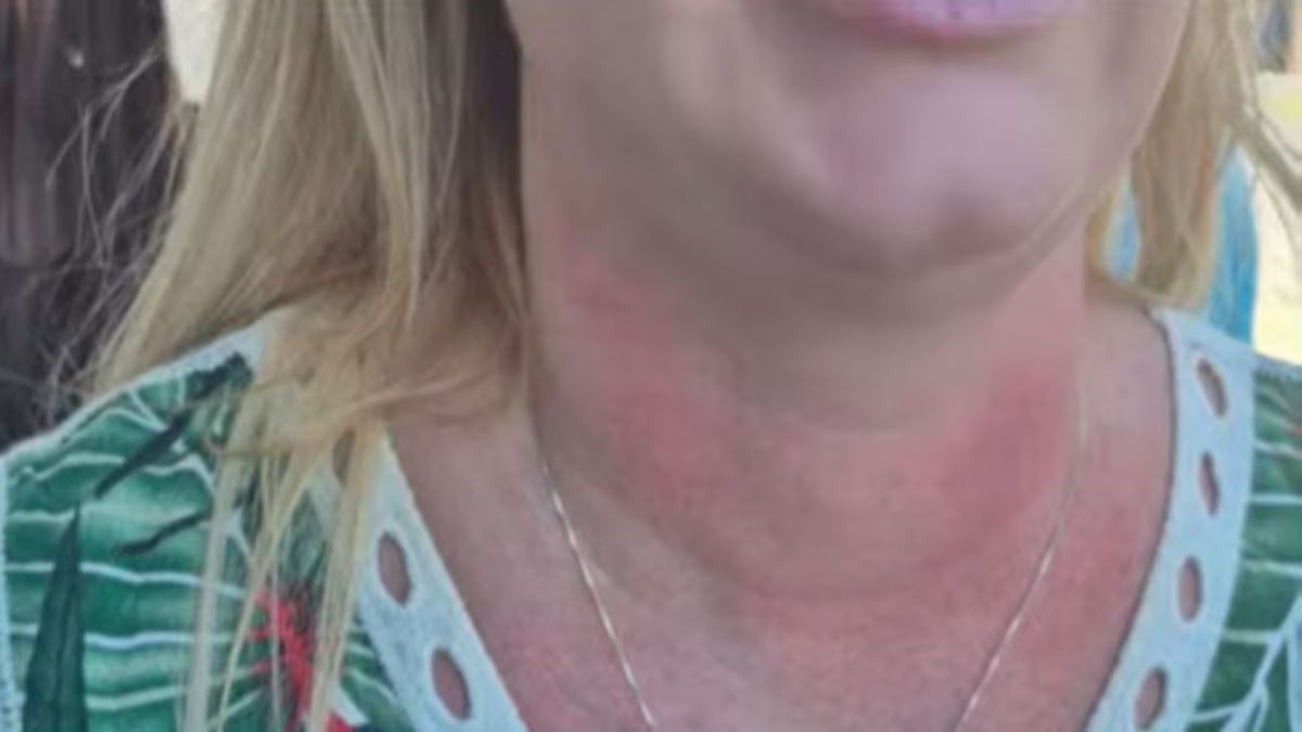 La víctima sufrió heridas y lesiones en distintas partes del cuerpo. (Foto: Mediodía Noticias) La víctima sufrió heridas y lesiones en distintas partes del cuerpo. (Foto: Mediodía Noticias)