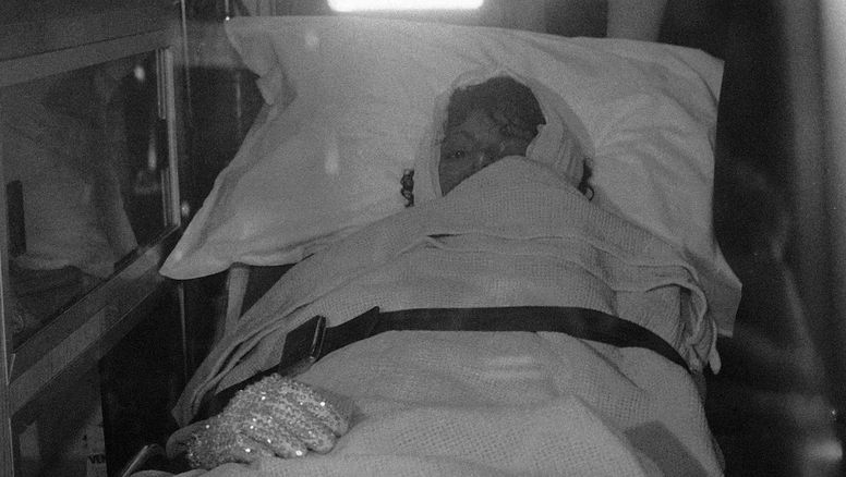 El accidente que cambió la vida de Michael Jackson: el día que su cabeza se prendió fuego