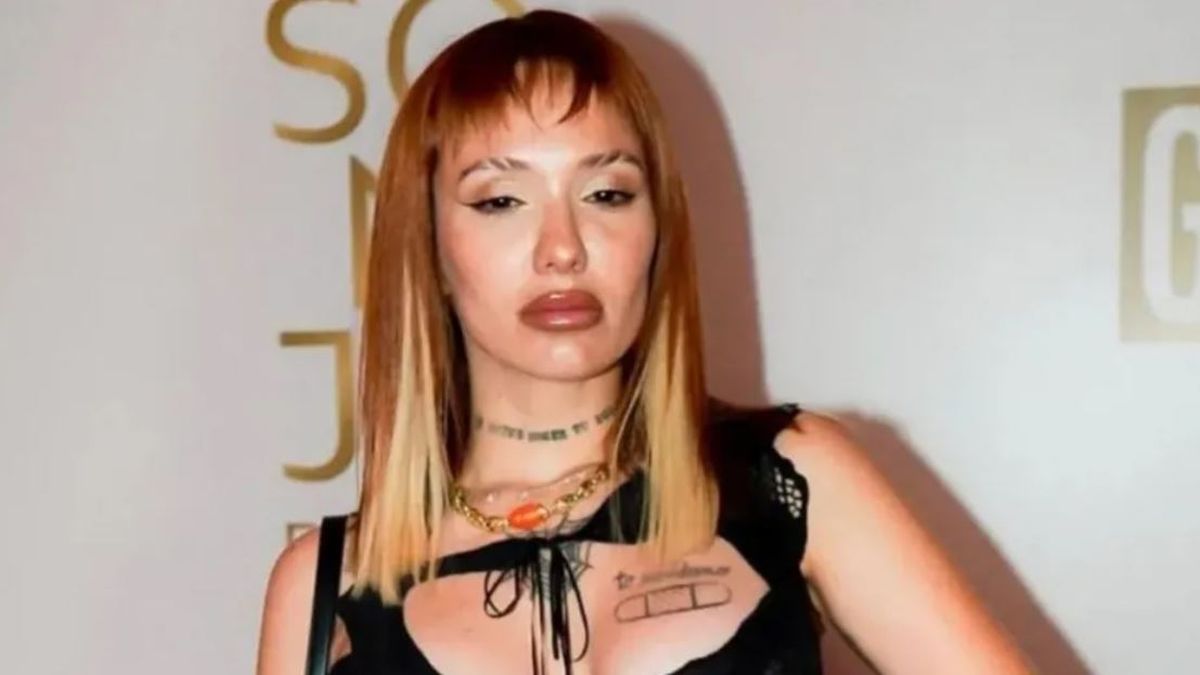 La Joaqui asegura que no se operó la cara. La Joaqui asegura que no se operó la cara.