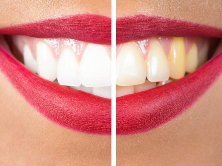 dientes.jpg