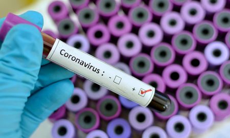 coronavirus: son 266 los confirmados y podria haber transmision comunitaria coronavirus: son 266 los confirmados y podria haber transmision comunitaria