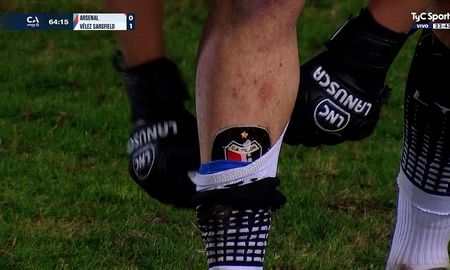¡Tenía puestas las canilleras de Colón campeón!: un futbolista de la Primera Nacional sorprendió a todos ¡Tenía puestas las canilleras de Colón campeón!: un futbolista de la Primera Nacional sorprendió a todos