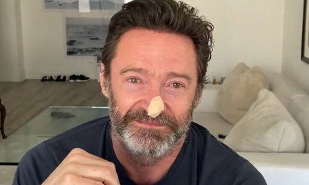 Hugh Jackman revela diagnóstico de cáncer de piel e insta a los fans a cuidarse Hugh Jackman revela diagnóstico de cáncer de piel e insta a los fans a cuidarse