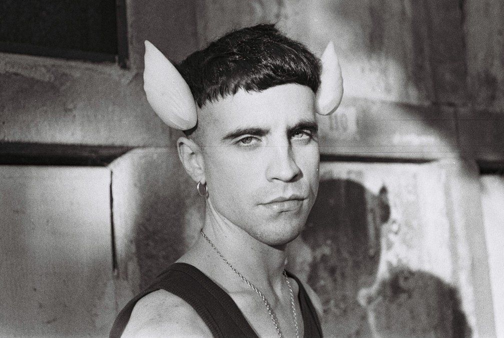 Un joven se implantó aletas de pez en la cabeza porque no se identifica como humano