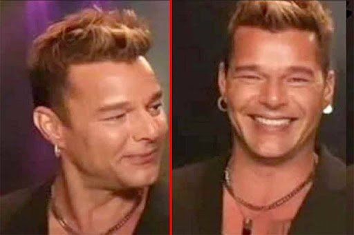 Ricky Martin se mostró con el rostro muy inflamado.