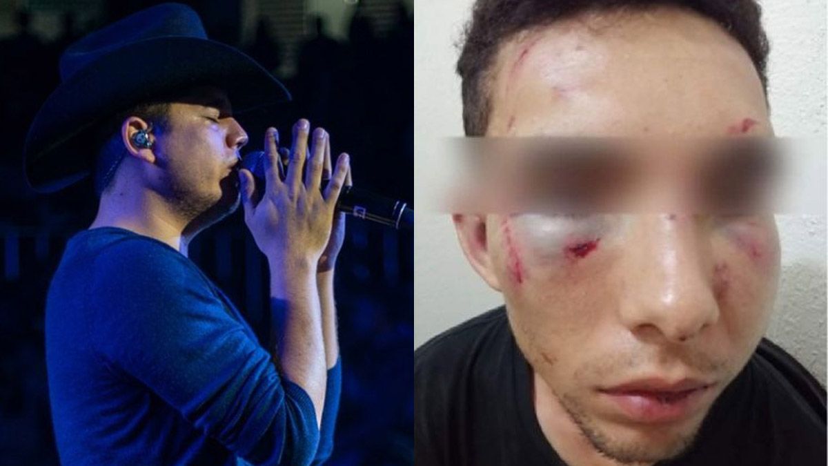 Remmy Valenzuela fue acusado de golpear brutalmente a su primo y a su novia