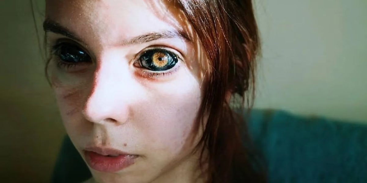 Se tatuó el blanco de los ojos para imitar a un cantante y quedó ciega: Pensé que se vería bien
