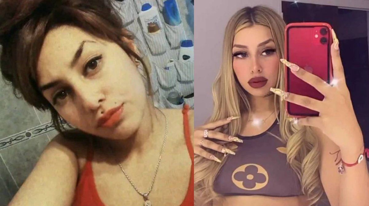 El impactante antes y después de Tamara Báez.