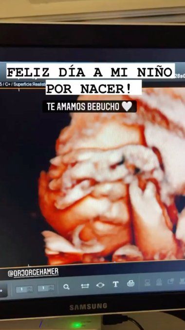 Juana Repetto compartió la ecografía de su hijo