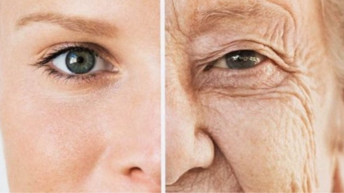 El exceso de azúcar daña el colágeno y la elastina