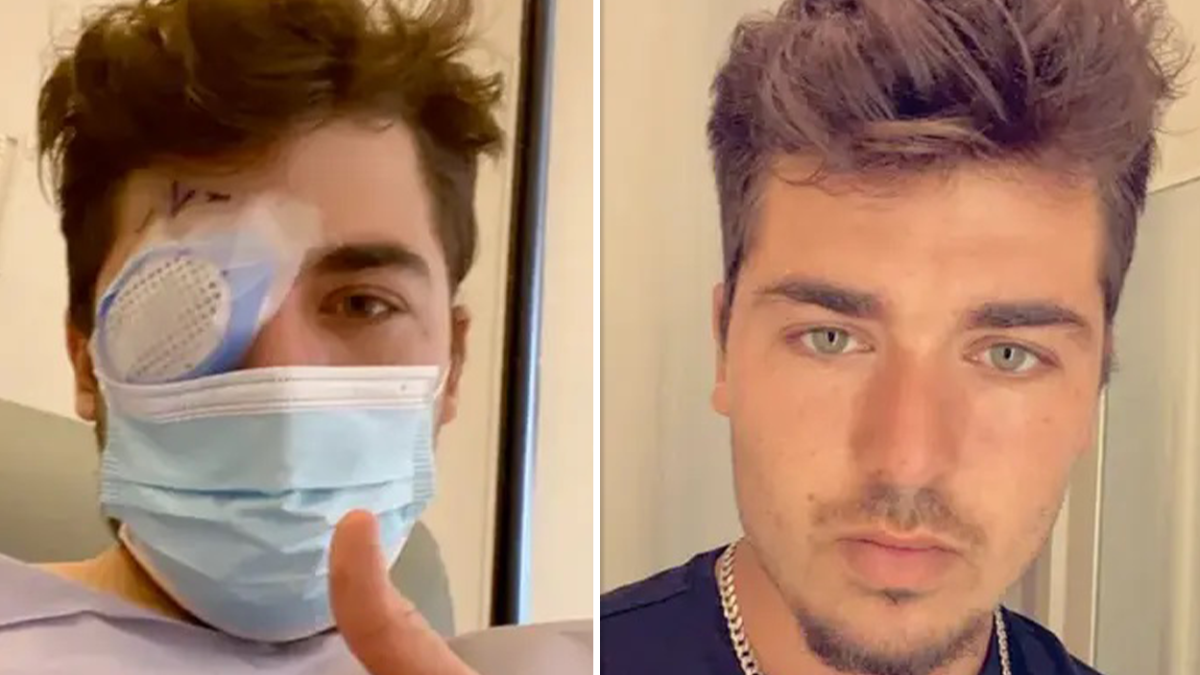 Viral: durmió una siesta de 40 minutos y se despertó ciego