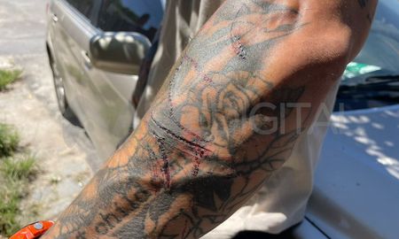 Damián sufrió cortes por parte de los delincuentes con un cuchillo cuando trababa la puerta de su casa para evitar que ingresen. Damián sufrió cortes por parte de los delincuentes con un cuchillo cuando trababa la puerta de su casa para evitar que ingresen.