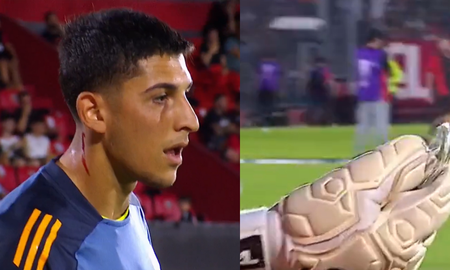 Violencia en Rosario: se demoró el partido de Newells porque agredieron a un jugador de Boca con un vidrio Violencia en Rosario: se demoró el partido de Newells porque agredieron a un jugador de Boca con un vidrio