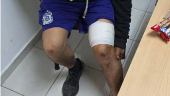 El exnovio de una tatuadora apuñaló a un cliente de la mujer en Chubut: creyó que era el amante