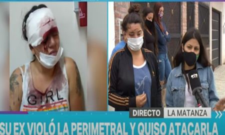 Defendió a su amiga del exnovio y terminó desfigurada Defendió a su amiga del exnovio y terminó desfigurada