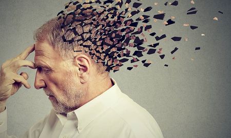 Los olvidos frecuentes no son solo descuidos. Según la Asociación del Alzheimer, la repetición constante de información alerta sobre el deterioro cognitivo. Los olvidos frecuentes no son solo descuidos. Según la Asociación del Alzheimer, la repetición constante de información alerta sobre el deterioro cognitivo.