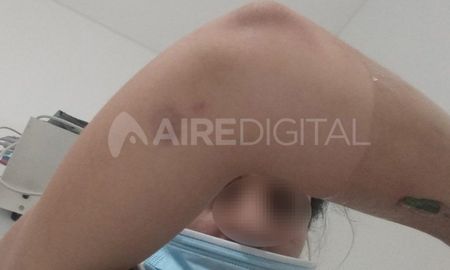 Habló Vanesa, víctima de violencia de género: Me decía morite, perra, puta, basura, mientras me golpeaba Habló Vanesa, víctima de violencia de género: Me decía morite, perra, puta, basura, mientras me golpeaba