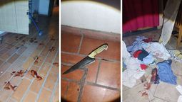 altText(Dormía, escuchó ruidos extraños y se encontró con un ladrón herido escapando por su patio)}