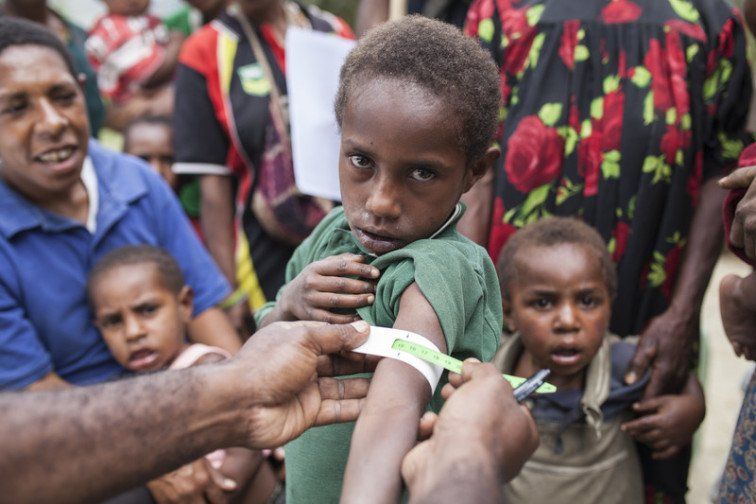 El misterio de la enfermedad no identificada que mata niños en Papúa Nueva Guinea