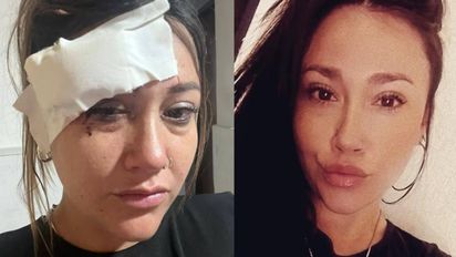 Horror en un cumple de 15: defendió a unas menores de un acosador y él le tajeó la cara con una copa