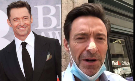 El actor Hugh Jackman, se hizo una biopsia y registró todo en sus redes sociales. Desde 2013, lo operaron varias veces de cáncer en la piel. El actor Hugh Jackman, se hizo una biopsia y registró todo en sus redes sociales. Desde 2013, lo operaron varias veces de cáncer en la piel.
