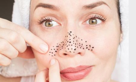 Cómo eliminar los puntos negros de manera efectiva y natural. Cómo eliminar los puntos negros de manera efectiva y natural.